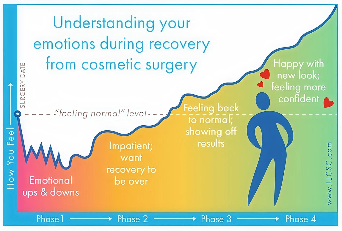 Emotional journey after cosmetic surgery recovery phases.