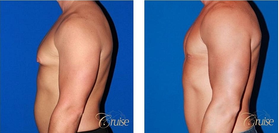 Before and after body transformation comparison.