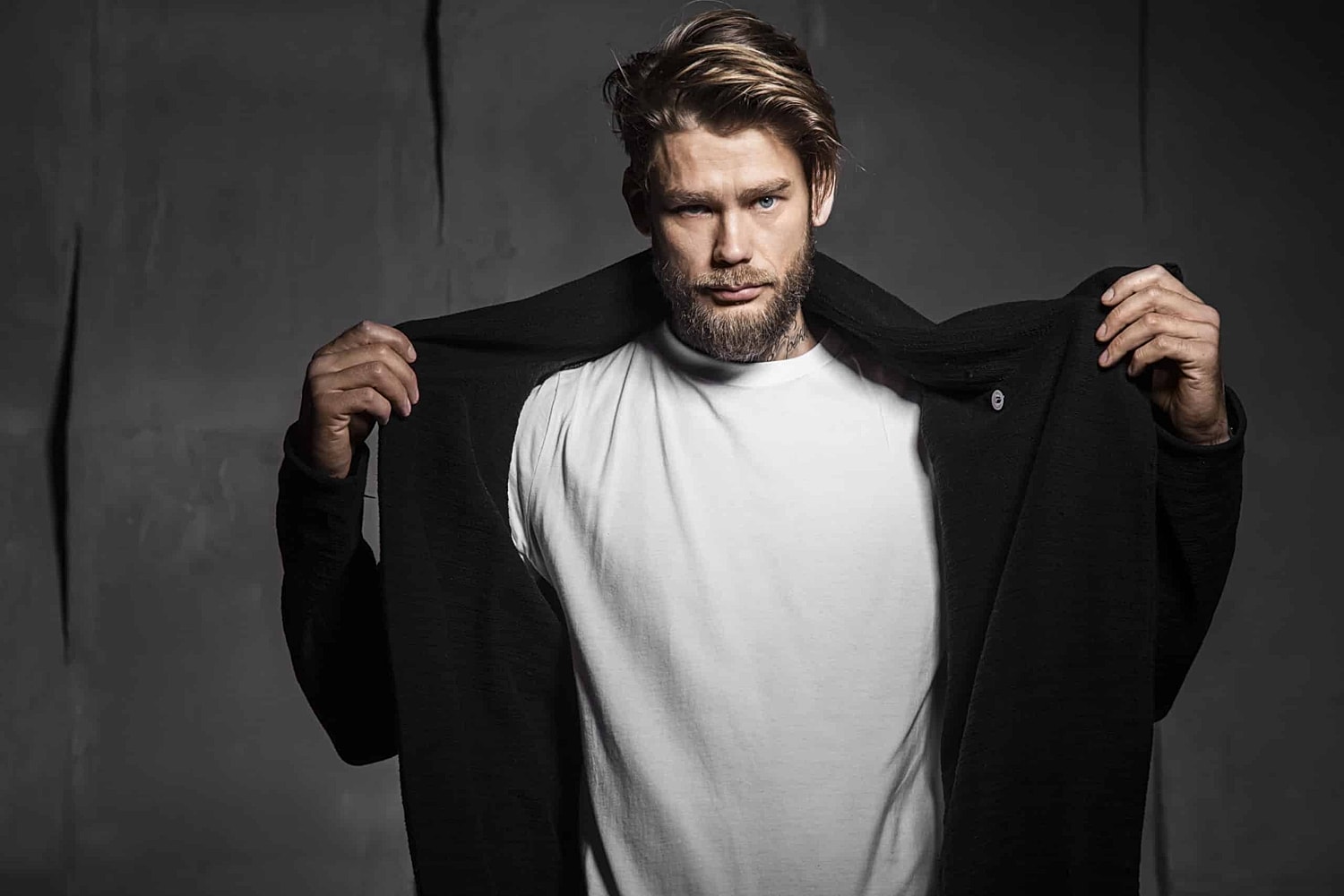 Common Problems Seen in Gynecomastia Revision Cases