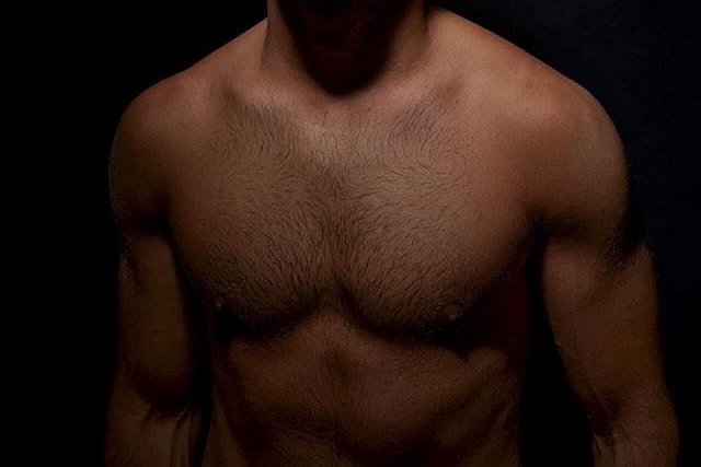 Gynecomastia Surgery Before and After: What to Expect