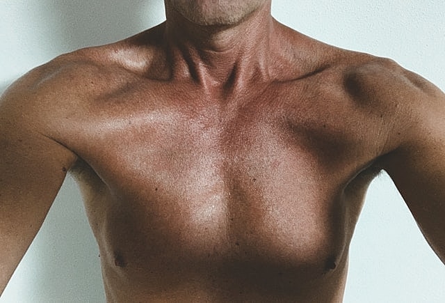Gynecomastia vs Chest Fat: How to Tell the Difference