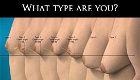 Man Boobs, Gyno or Moobs: What Do You Call Male Breasts?