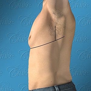 Side view of a male torso with markings.