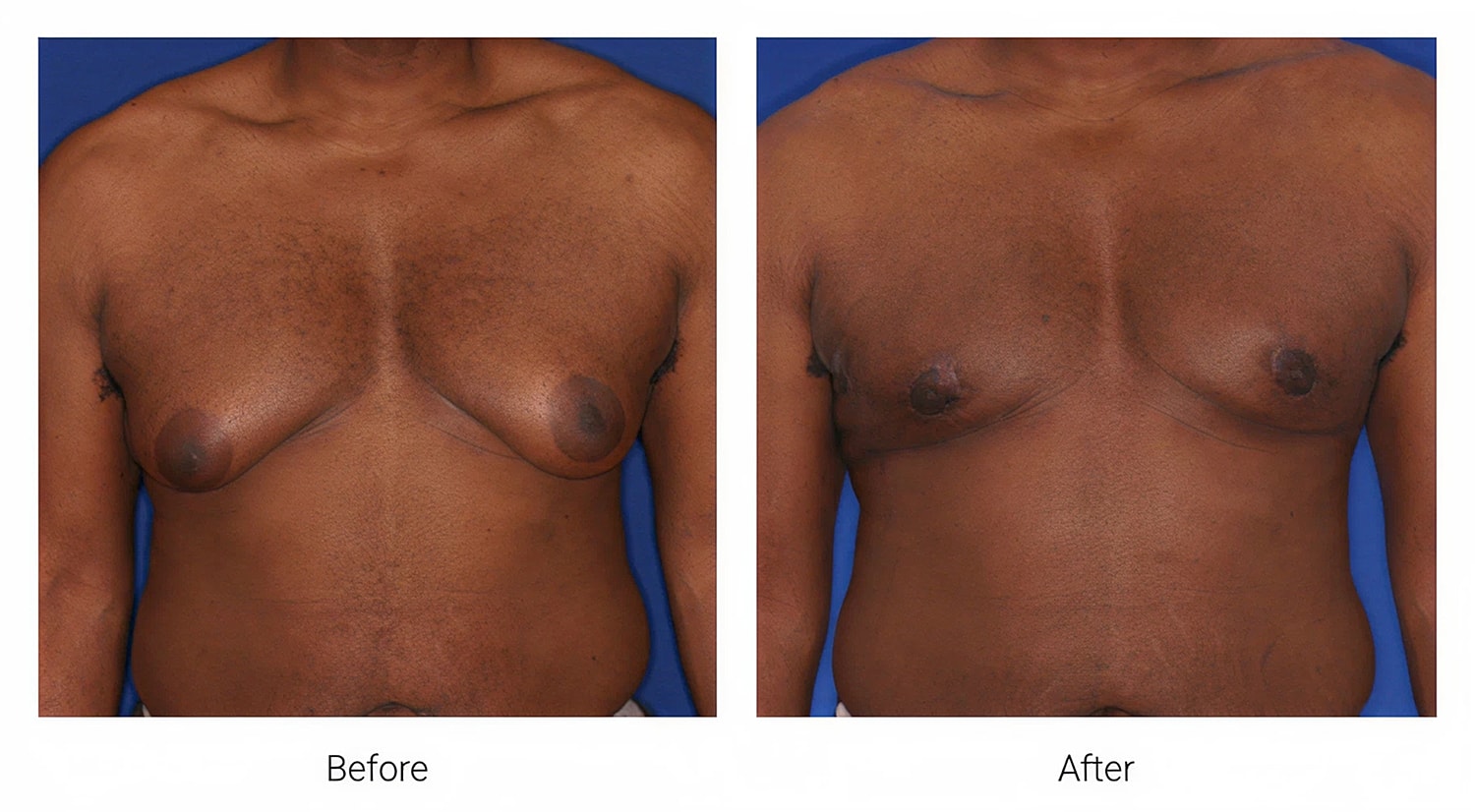 Before and after body transformation images.