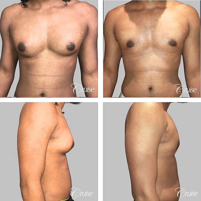 Before and after body transformation images.