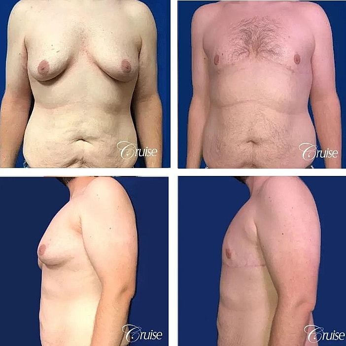 Before and after body transformation images.