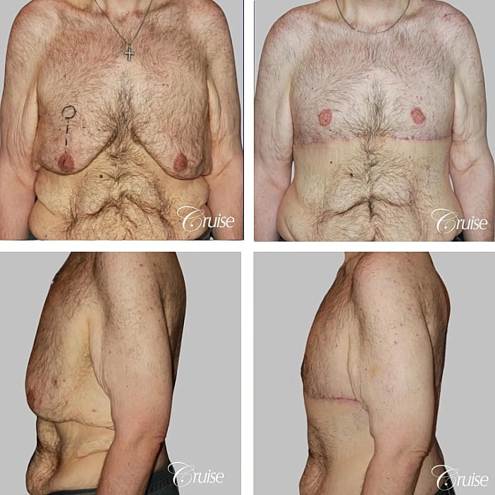 Before and after body transformation photos.