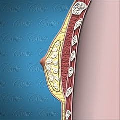 Human torso, front view, neutral background.