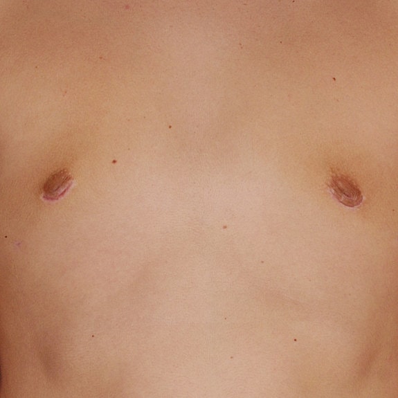 Man's torso against a blue background.