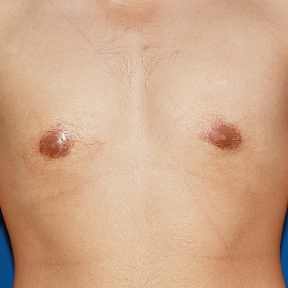 Hairy male chest with visible nipples.