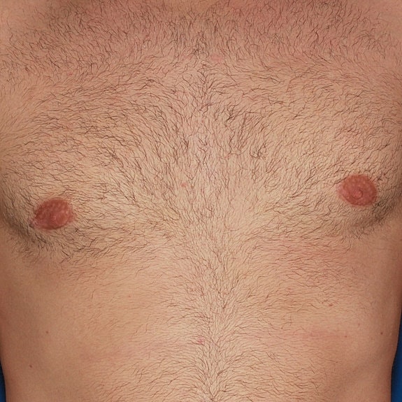 Hairy male chest and nipples.