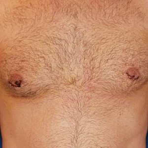Hairy male torso with visible nipples.