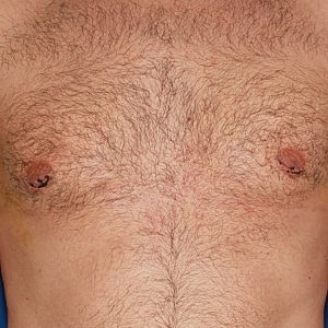 Hairy male chest with visible nipples.
