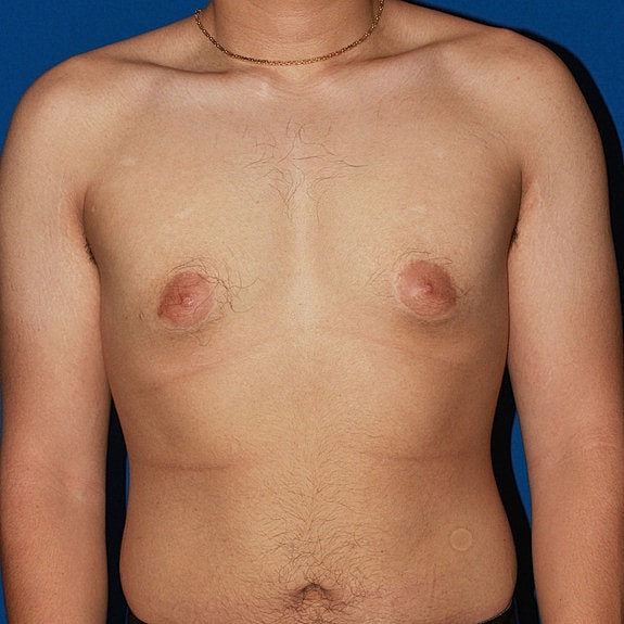 Man's torso against a blue background.