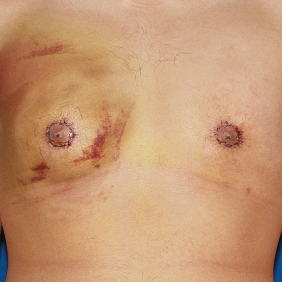 Hairy male torso with visible nipples.