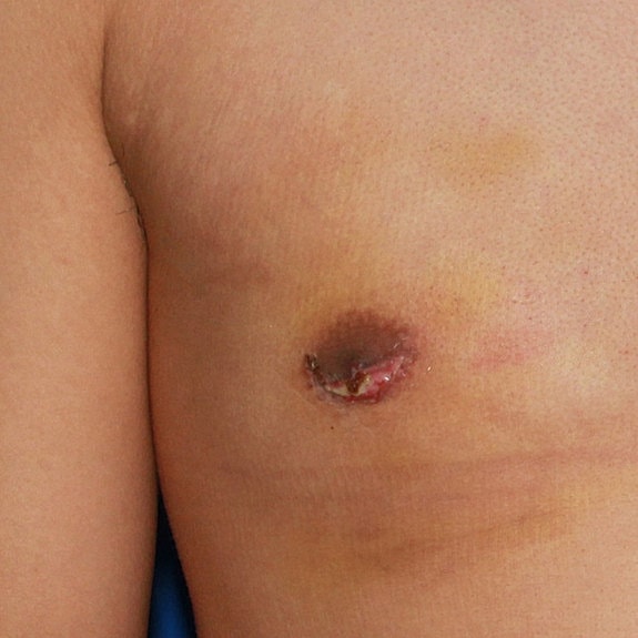 Man's torso against a blue background.