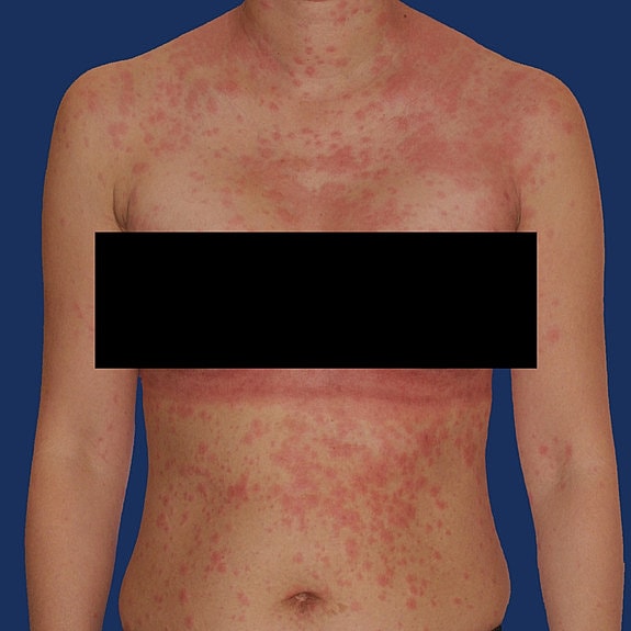 Man's torso against a blue background.