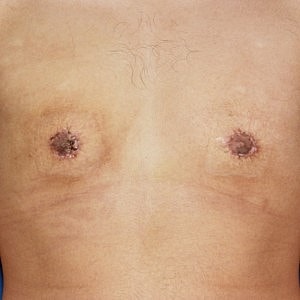 Hairy male chest with visible nipples.