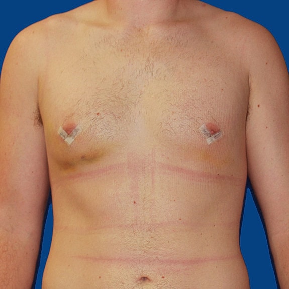 Man's torso against a blue background.