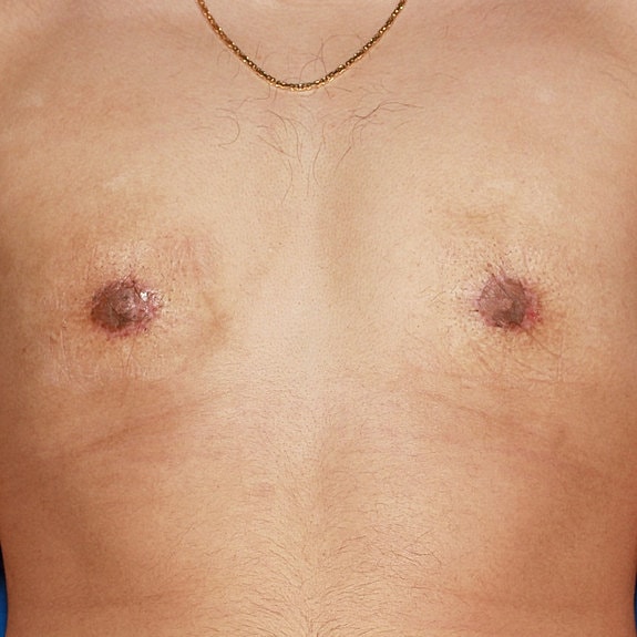 Hairy male chest and nipples.