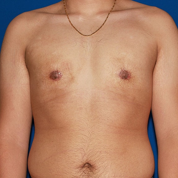 Male torso with visible chest and necklace.