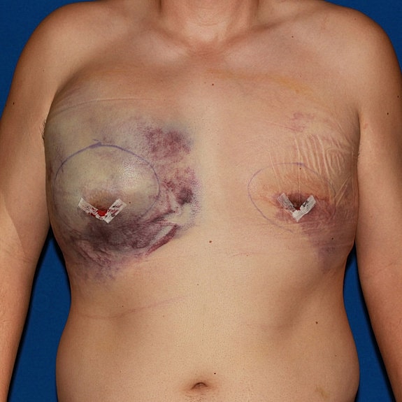 Man's torso against a blue background.