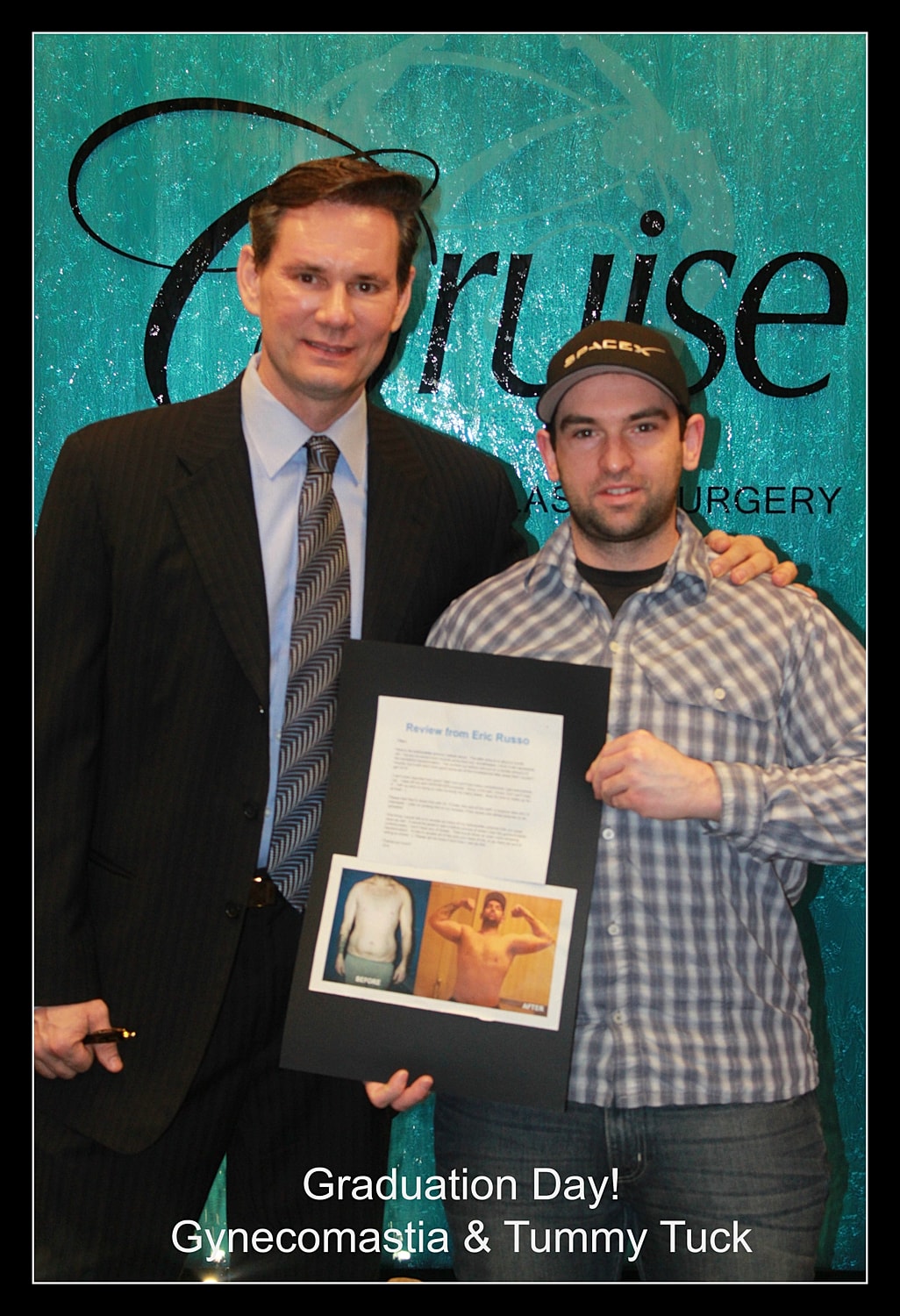 Graduation celebration for gynecomastia and tummy tuck.