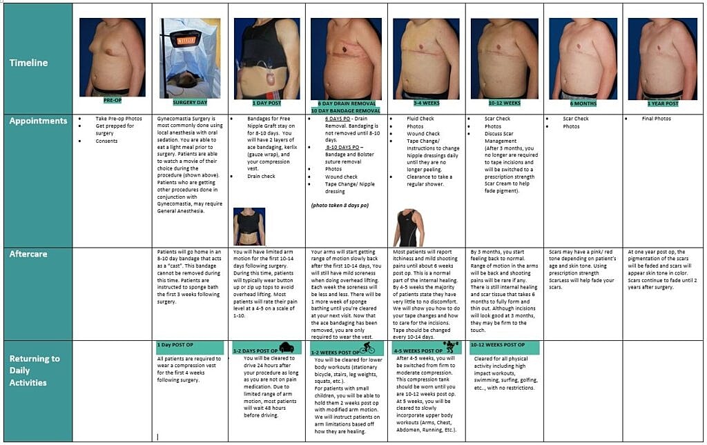 Gynecomastia surgery recovery timeline and aftercare.