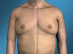 Male torso with visible chest and skin tone.