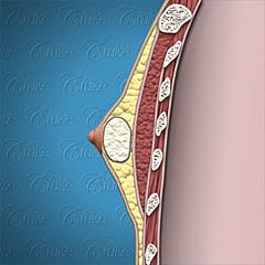 Anatomical cross-section of human tissue layer.
