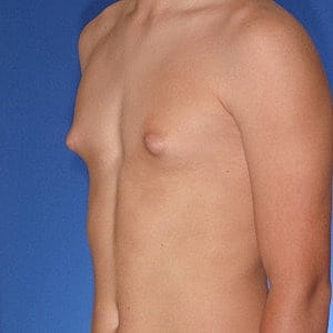 Side profile of a person’s torso.