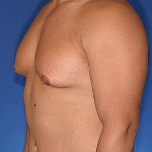 Side profile of a male torso.