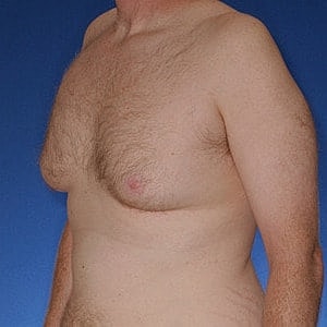 Male torso with chest hair against blue background