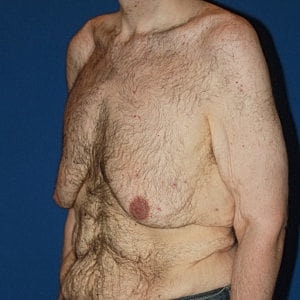 Bare-chested man with visible hair and skin.