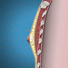 Anatomical illustration of human chest muscles.