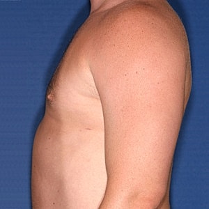 Side profile of a shirtless man.