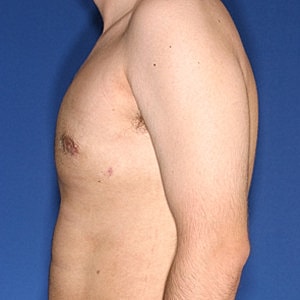 Side view of a bare male torso.