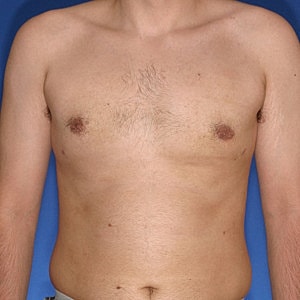 Bare-chested man with neutral background.