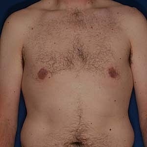 Male torso with body hair and no shirt.