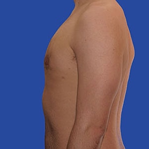 Side profile of a person's upper body.