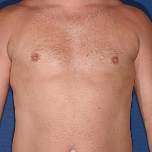 Male torso with hair, no clothing.