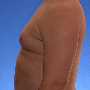 Side profile of a person's torso.