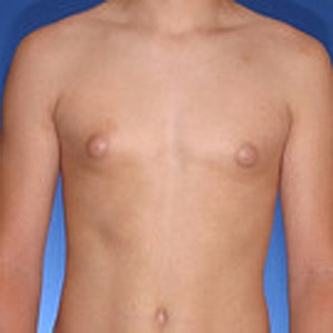 Bare-chested individual with plain background.