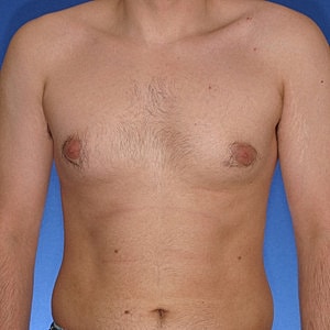 Male torso on blue background