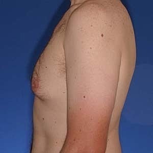 Side profile of a bare-chested male.