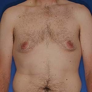 Male torso with body hair against blue background