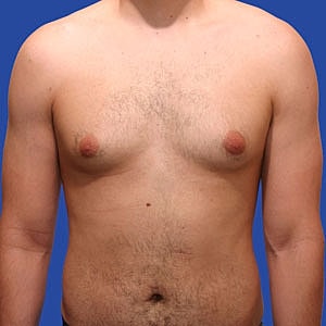 Adult male torso against a blue background.