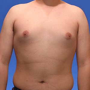 Bare-chested person against blue background.