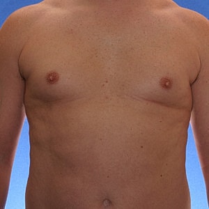 Male torso with no shirt on.