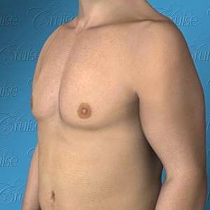 Side view of a bare torso against blue background.
